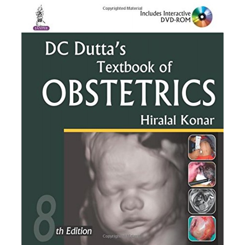 Obstetrics by Dutta