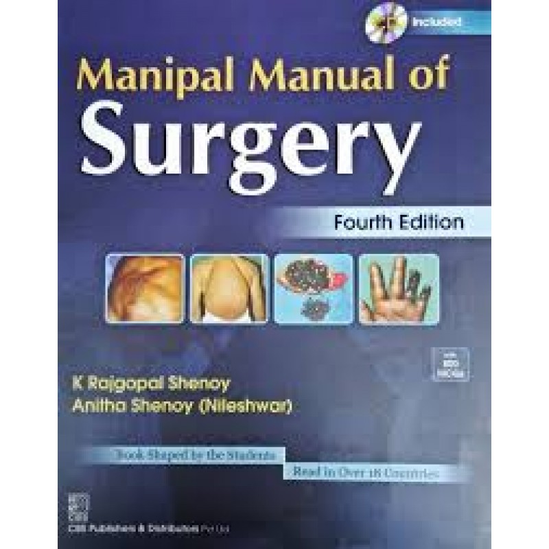 Surgery by Manipal
